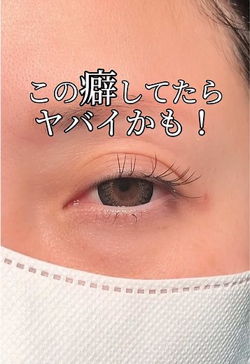 眼瞼下垂についての注意点と改善策