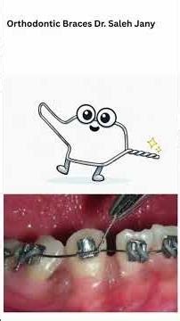 The Braces Band part 2 Orthodontics | Original Song by Dr. Saleh Jany