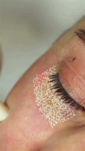 see beautiful results of Alpha CO2 laser in the end of video #duet #co2laser #satisfying