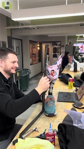 Assembling a Transtibial Prosthesis