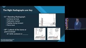 Basic Limb Alignment: Why Deformity Matters