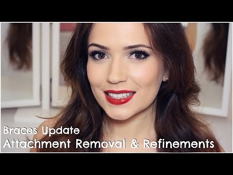 Invisalign | Attachments Removal & Refinements