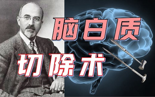 【科学八卦史】一个精神病医生是怎么酿成近代最大医学惨剧的