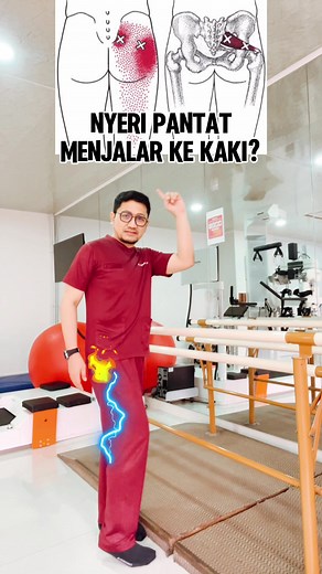 nyeri pantat menjalar ke kaki? lakukan ini #drpras #sciatica #lowbackpain #nyeripinggang #onedayonetiktok
