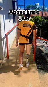 #artificialleg #abovekneeprosthesis #userexperience #highlightsシ゚ #followersreelsfypシ゚viralシfypシ゚viralシalシ | Making prosthesis leg