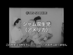 【TBSスパークル】シャム双生児（アメリカ）Siamese twins