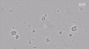 显微镜下的肝癌细胞HEP-G2细胞