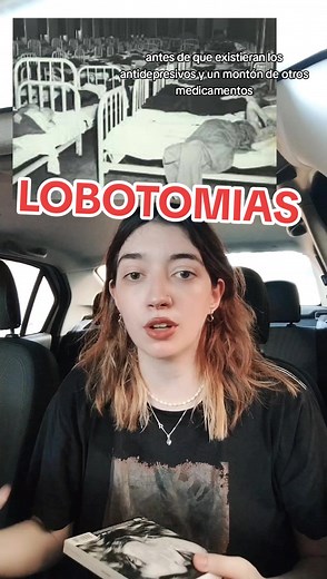 Explorando la Historia y Contexto de la Lobotomía