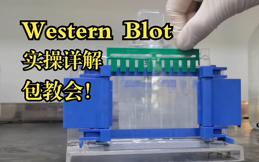 【Western Blot】包教包会！导师当院士这事就靠你了| WB实操详解＆蛋白免疫印迹