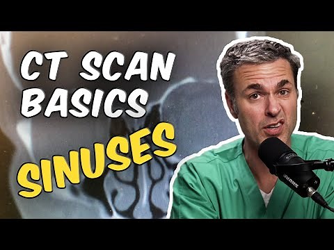 Normal versus abnormal on CT Sinus