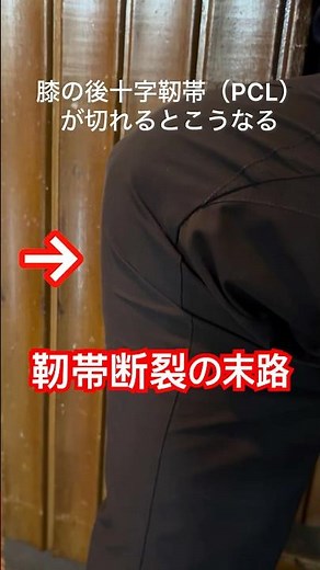膝の靭帯（後十字靭帯）断裂の末路 #rehub #リハビリ #膝痛 #ゴルフ #手術