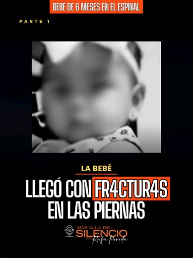 ¡Nos rompe el corazón! La b3bé de 6 meses de #ElEspinal llegó al hospital con fr4ctur4as en sus piernitas. #Podcast en el link de nuestro perfil.