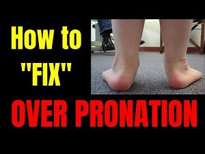 How to REALLY "Fix" Overpronation Flat feet and Collapsed Arches (TRUTH + Exercises)