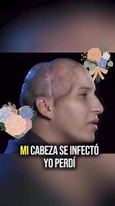12M views · 169K reactions | Este es el Poder del Dios qe Salva y trasforma Vidas Aleluyaaaa  Los Invitó a qe veamos este poderoso testimonio de Poder de Dios en la vida de este Hnito ❤️‍啕懶️ | Clarita Paz Hernandez | Facebook