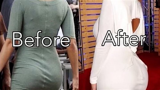 Amber Rose explains why she reversed her curvy Brazilian butt lift