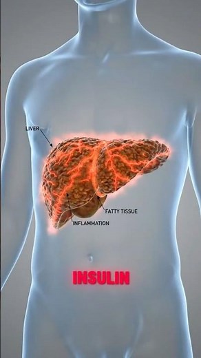 Why Your Liver Hates High Fructose Corn Syrup ⚠️
