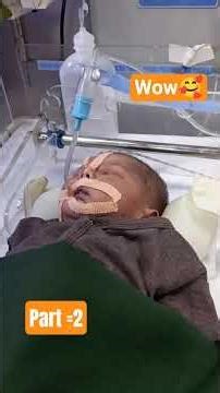 critical baby care on E. T. cpap#part2