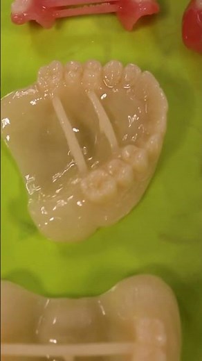 Revolutionary Denture Tech with Lucitone Digital Print 🦷 from Dentsply Sirona