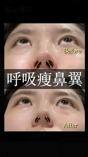 Chinese Facial Eight-Section Broade! (Chinese Facial Exercise) #beauty #beautyhacks #facialyoga