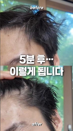 새치 때문에 고민이라면 이거 보세요🔥 새치 염색샴푸 추천