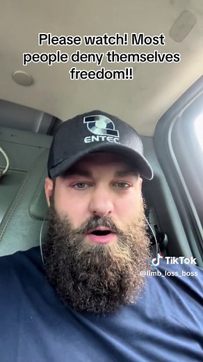 Desensitizing for Mobility: Walking on End Stumps Explained