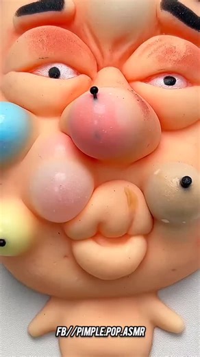 Press → Pop → Instant Relief 😌🔥 Watch till end ... 💗 #PimplePopping #PimplePopper #PimplePopToy #OddlySatisfying #SatisfyingVideos #ViralReels #SatisfyingContent #PimpleSqueeze #StressReliefToy #FidgetToy #ASMRVideo #TrendingNow #ViralVideo #RelaxingReels #SoSatisfying #Poplt #PimpleLover #SatisfyingToy #SatisfyingReels #TrendingWorldwide #ViralOnFacebook #SatisfyingMoments #PoppingFun #fypppppppppppppppppppppppppppppppppppppppppppppppppppppppppppppppppppppp #SatisfyZone #viralreels | Face Po