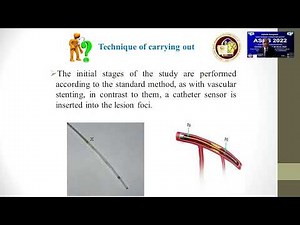 Intravascular ultrasound IVUS