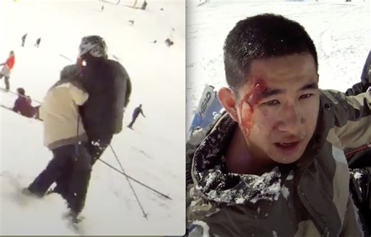 Out of Control Skier Bloodied After Causing Collision