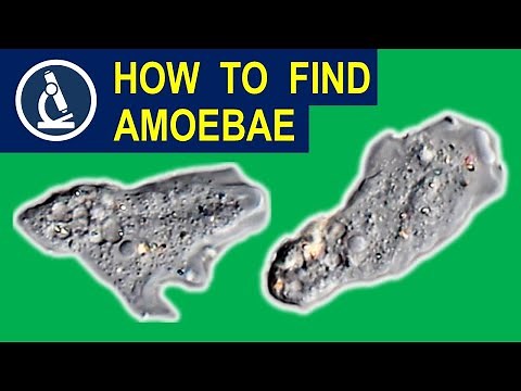 Where and how you can find AMOEBAE for your microscope 🔬 174
