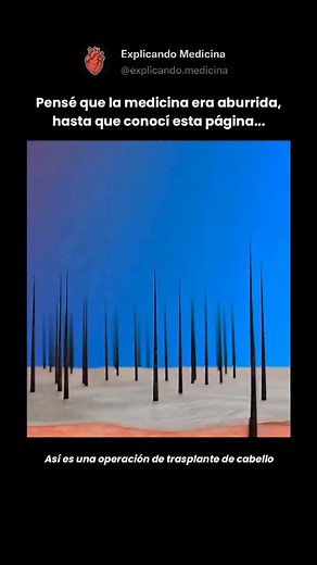 651K views · 1.9K reactions | El trasplante de cabello es un...