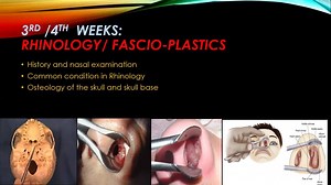 DOHNS OSCE COURSE https://www.mrcscourses.org/ By Mr Sherif Mamdouh Consultant Otolaryngologist, Head & Neck Surgeon Join Our Free Group https://t.me/joinchat/EyRywFkXOAck2Xp6m03fsA | Coursemia