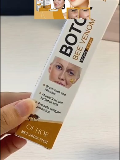 How to Use Botox Cream for Wrinkle Reduction