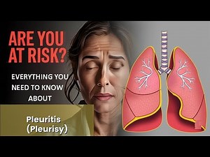 Pleuritis (Pleurisy) Explained Causes, Symptoms and Treatment, All Insights