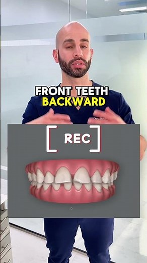 Do I have to fix my overbite?