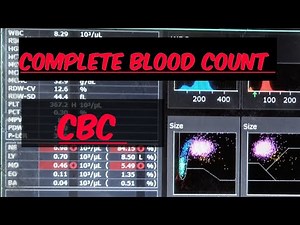 Complete Blood Count | CBC & It's Importance | CBC Parameters | Made Easy