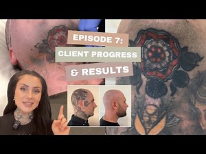 Laser Tattoo Removal Client Progress & Results