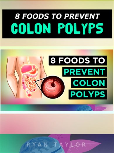 8 Foods To PREVENT Colon Polyps #polyps #colon #digestivehealth #ryantaylornaturalremedies #nutrition