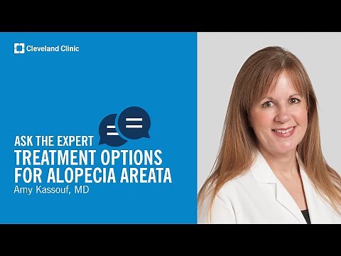 Treatment Options for Alopecia Areata | Ask Cleveland Clinic’s Expert