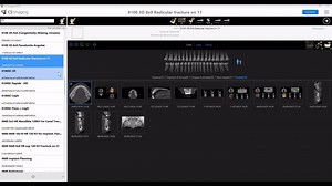 Le tuto logiciel du jour : Comment vérifier sa version de CS 3D Imaging ? En savoir plus: https://ow.ly/IzzV50WvTjl Dispositif médical, Classe IIa, marqué CE, non remboursable. Lire attentivement la notice d’utilisation. | Carestream Dental | Facebook