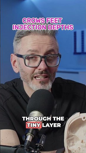 Crow's feet injection depth