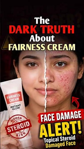 The Dark Truth About Fairness Creams 😨 | Dangerous Side Effects of Steroid Creams! #skincare #cream
