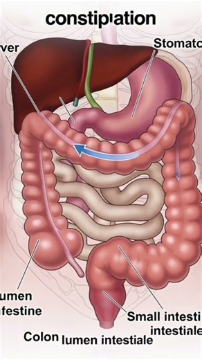 Inside the Colon: Effects of Constipation Explained | Medi Shorts