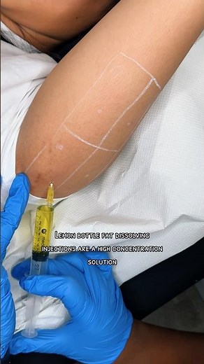 Lemon Bottle 🍋 | Fat Dissolving Injections | #fatdissolving #fatreduction