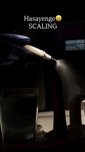 “Scaling ➡️ RCT ➡️ Extraction 😱 The Dental Reality 😂🦷#DentistLife #Shorts#ytshorts#dentist#doctor