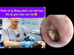 How to deal with a cockroach crawling into your ear - ASMR耳掃除 | Doctor Hieu Long Bien
