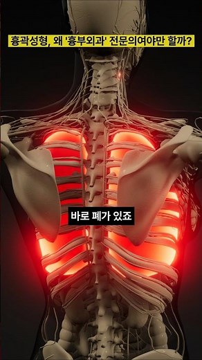 Ribcage Correction Surgery: Why Aftercare Is Essential When Repositioning Ribs