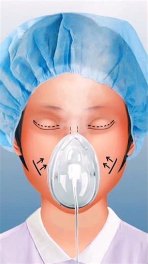 Satisfying Surgery ASMR Animation 💉 #asmrskincare #asmrvideo #animation #makeup #skincareroutine