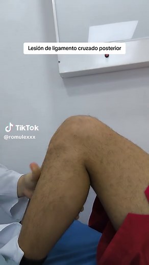 Lesión de Ligamento Cruzado Posterior: Síntomas y Diagnóstico