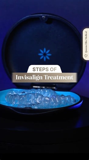 How Does Invisalign Work Step by Step? | From Scan to Smile
