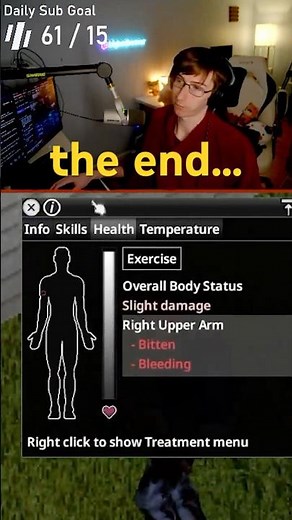 My BEST CDDA Survivor Went Out SUFFERING... (Project Zomboid)